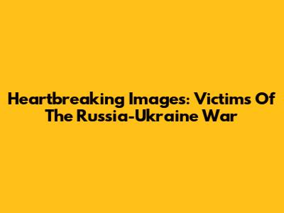 Heartbreaking Images: Victims Of The Russia-Ukraine War