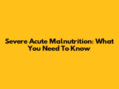 Severe Acute Malnutrition: What You Need To Know